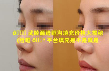 🐎 武陵源睑眶沟填充价格大揭秘(睑眶 🌺 平台填充是不是就是泪沟填充)